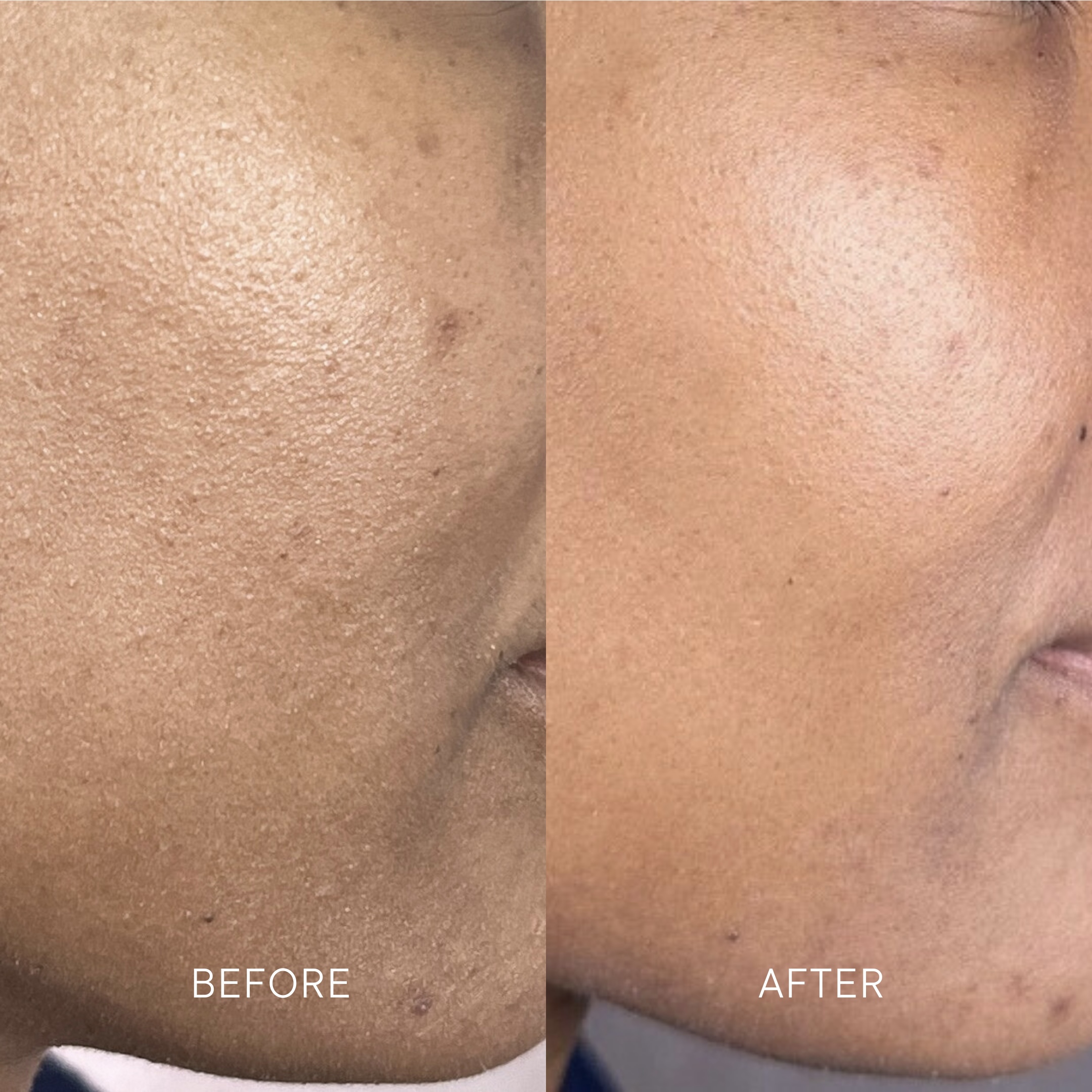 Artisa skincare before and after · before and after composite