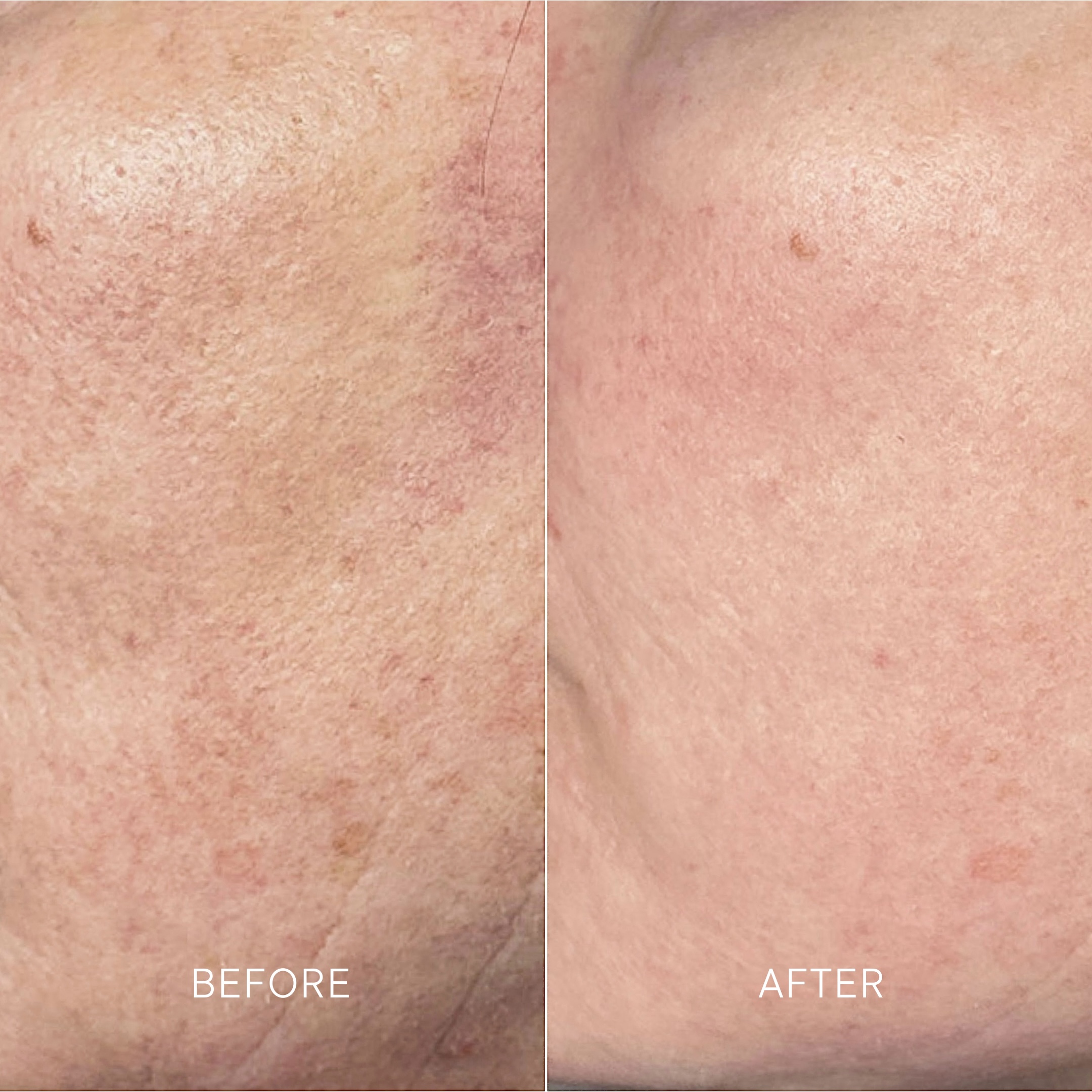 Artisa skincare before and after · before and after composite