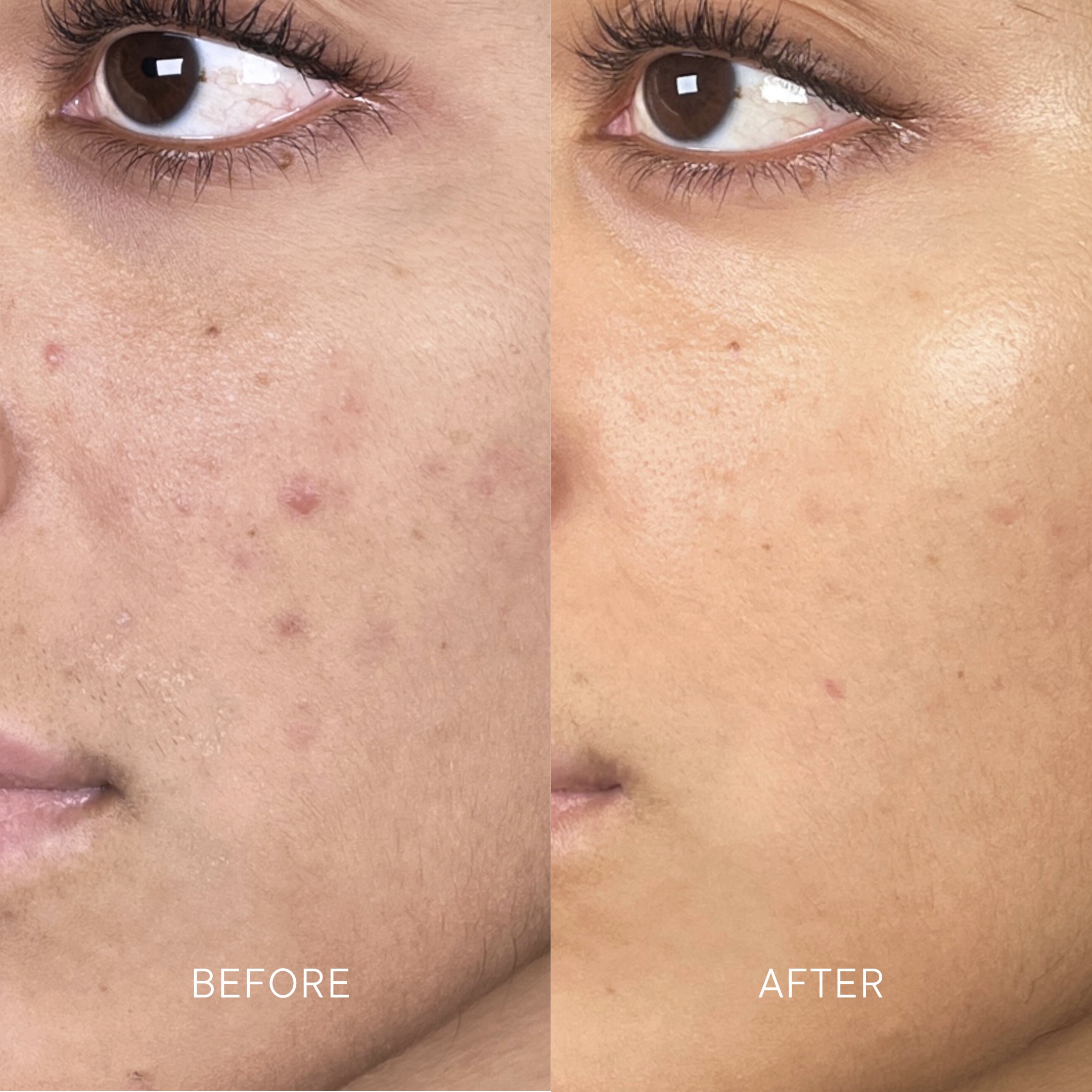 Artisa skincare before and after · before and after composite