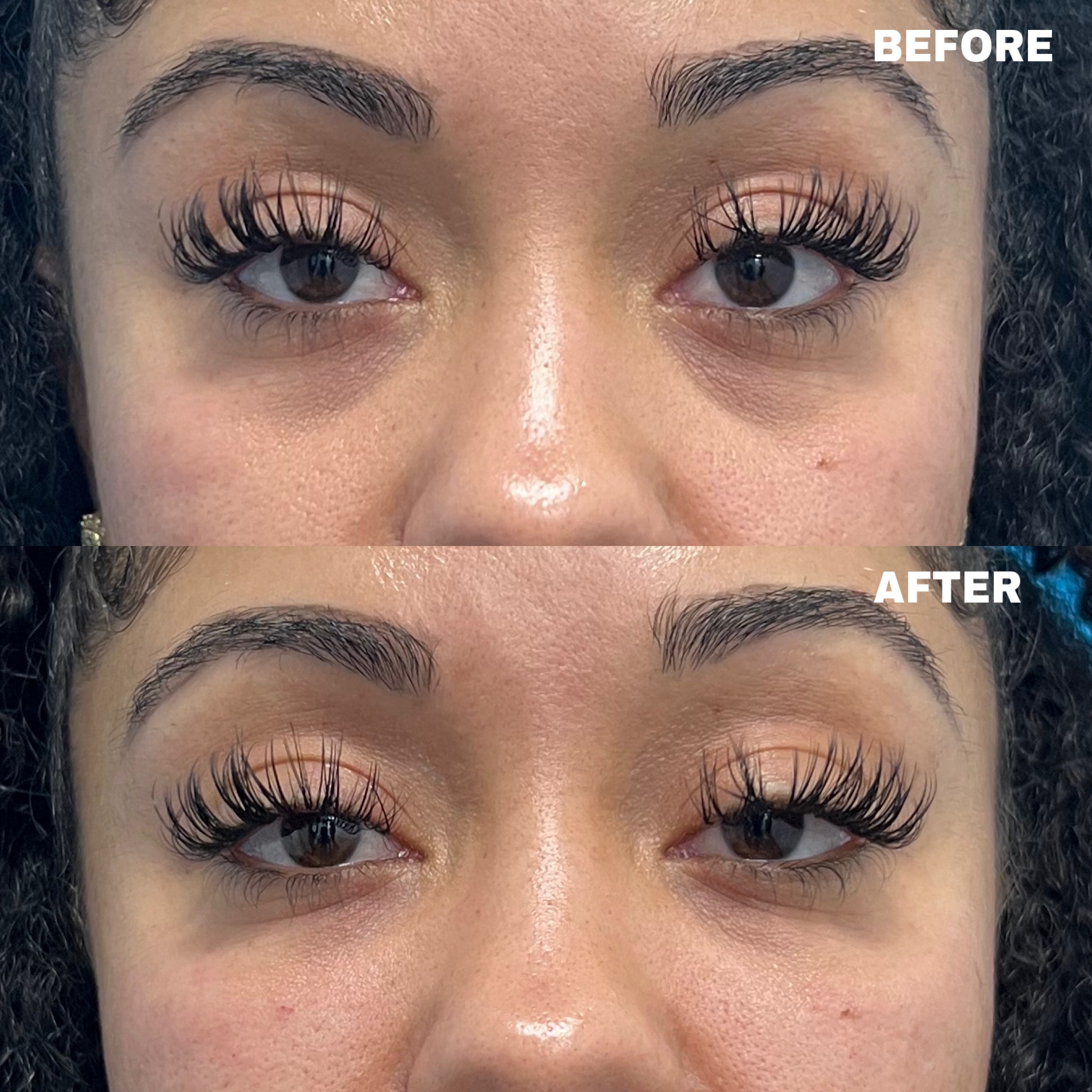 Dermal filler before and after · before and after composite